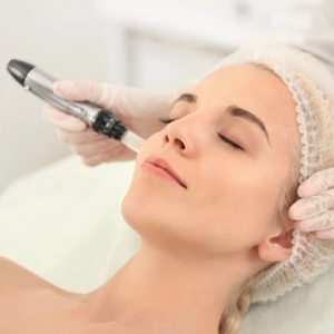 Curso de Microagulhamento